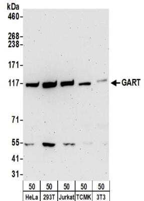 Western Blot: GART Antibody [NBP2-32206] - Samples:  Whole cell lysate (50 ug) from HeLa, 293T, Jurkat, mouse TCMK-1, and mouse NIH3T3 cells. Antibodies:  Affinity purified rabbit anti-GART antibody NBP2-32206 used for WB at 0.1 ug/ml.  Detection: Chemiluminescence with an exposure time of 3 minutes.