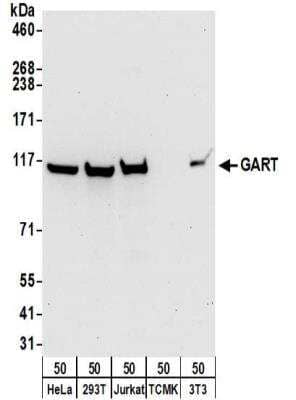 Western Blot: GART Antibody [NBP2-32207] - Samples:  Whole cell lysate (50 ug) from HeLa, 293T, Jurkat, mouse TCMK-1, and mouse NIH3T3 cells.  Antibodies:  Affinity purified rabbit anti-GART antibody NBP2-32207 used for WB at 0.1 ug/ml.  Detection: Chemiluminescence with an exposure time of 30 seconds.