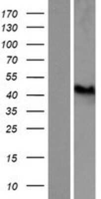 Western Blot: GART Overexpression Lysate (Adult Normal) [NBP2-05080] Left-Empty vector transfected control cell lysate (HEK293 cell lysate); Right -Over-expression Lysate for GART.