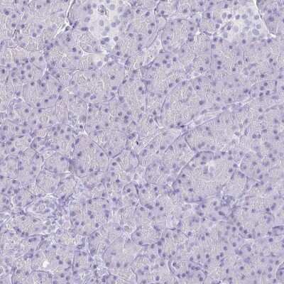Immunohistochemistry-Paraffin GAS2 Antibody - BSA Free