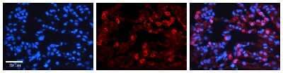 Immunohistochemistry: GAS2L1 Antibody [NBP1-58112] - Human Lung Tissue Observed Staining: Cytoplasm of pneumocytes Primary Antibody Concentration: 1 : 100 Secondary Antibody: Donkey anti-Rabbit-Cy3 Secondary Antibody Concentration: 1 : 200 Magnification: 20X Exposure Time: 0.5 - 2.0 sec.