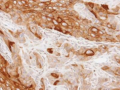 Immunohistochemistry-Paraffin GAS2L1 Antibody