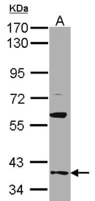 Western Blot: GAS2L1 Antibody [NBP1-32310] - Sample(30 ug of whole cell lysate)A:A431 7. 5% SDS PAGE, antibody diluted at 1:500.