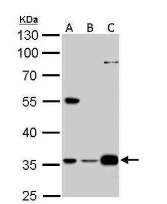 Western Blot: GAS2L1 Antibody [NBP1-32310] - A. 30 ug A431 whole cell lysate/extract B. 30 ug HeLa whole cell lysate/extract C. 30 ug A375 whole cell lysate/extract 10 % SDS-PAGE GAS2L1 antibody dilution: 1:1000