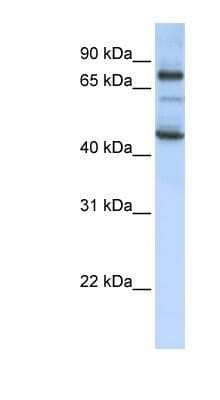 Western Blot: GAS2L1 Antibody [NBP1-58112] - MCF-7 whole cell lysates, concentration 0.2-1 ug/ml.