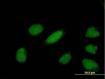 Immunocytochemistry/Immunofluorescence: GAS41 Antibody [H00008089-B01P] - Analysis of purified antibody to YEATS4 on HeLa cell. (antibody concentration 10 ug/ml)