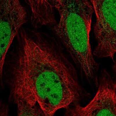 Immunocytochemistry/Immunofluorescence: GAS41 Antibody [NBP2-56393] - Staining of human cell line U-2 OS shows localization to nucleoplasm.