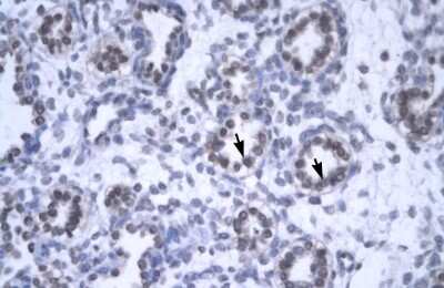 Immunohistochemistry-Paraffin: GAS41 Antibody [NBP3-10887] - Immunohistochemical analysis of paraffin-embedded human lung tissue.