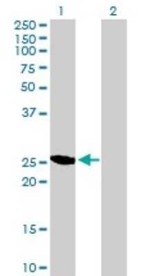 Western Blot: GAS41 Antibody [H00008089-B02P] - Analysis of YEATS4 expression in transfected 293T cell line by YEATS4 polyclonal antibody.  Lane 1: YEATS4 transfected lysate(24.97 KDa). Lane 2: Non-transfected lysate.