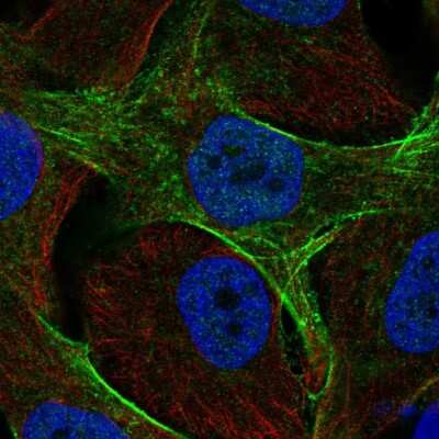 Immunocytochemistry/Immunofluorescence: GAS7 Antibody [NBP2-49422] - Staining of human cell line SK-MEL-30 shows localization to plasma membrane & actin filaments. Antibody staining is shown in green.