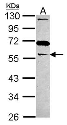 Western Blot: GAS7 Antibody [NBP2-14965] - Sample (30 ug of whole cell lysate) A: A431 10% SDS PAGE, antibody diluted at 1:3000.