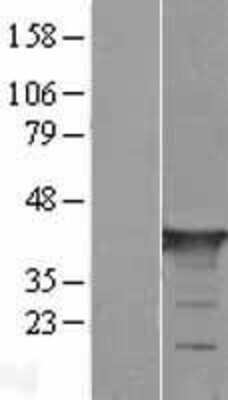 Western Blot: GAS7 Overexpression Lysate (Adult Normal) [NBL1-10976] Left-Empty vector transfected control cell lysate (HEK293 cell lysate); Right -Over-expression Lysate for GAS7.