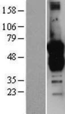 Western Blot GAS7 Overexpression Lysate