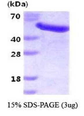 SDS-PAGE Recombinant Human GAS7 His Protein