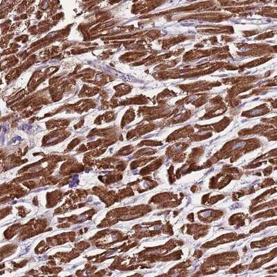 Immunohistochemistry-Paraffin: GAS8 Antibody [NBP2-14038] - Staining of human heart muscle shows strong cytoplasmic positivity in myocytes.