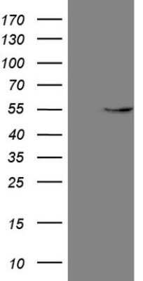 Western Blot: GAS8 Antibody (OTI10G2) - Azide and BSA Free [NBP2-70795] - Analysis of HEK293T cells were transfected with the pCMV6-ENTRY control (Left lane) or pCMV6-ENTRY GAS8.
