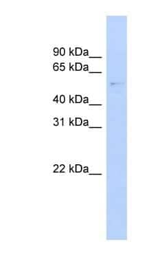 Western Blot: GAS8 Antibody [NBP1-55497] - Titration: 0.2-1 ug/ml, Positive Control: MCF7 cell lysate.