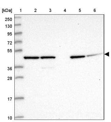 Western Blot: GAS8 Antibody [NBP2-14038] - Lane 1: Marker  [kDa] 250, 130, 95, 72, 55, 36, 28, 17, 10.  Lane 2: Human cell line RT-4.  Lane 3: Human cell line U-251MG sp.  Lane 4: Human plasma (IgG/HSA depleted).  Lane 5: Human liver tissue.  Lane 6: Human tonsil tissue