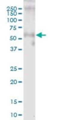 Western Blot: GASP-1/WFIKKNRP/WFIKKN2 Antibody [H00124857-B01P] - Analysis of WFIKKN2 expression in human colon.