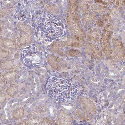 Immunohistochemistry: GASP-2/WFIKKN Antibody [NBP2-37904] - Staining of human kidney shows moderate cytoplasmic positivity in cell in tubules.