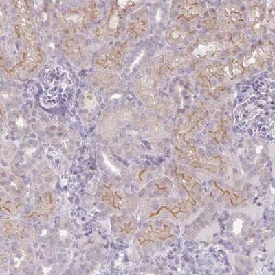 Immunohistochemistry: GASP-2/WFIKKN Antibody [NBP2-37910] - Staining of human kidney shows moderate cytoplasmic and membranous positivity in cell in tubules.