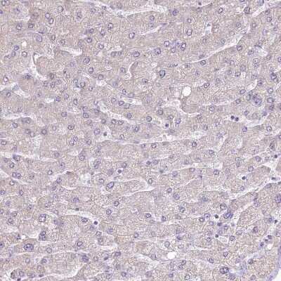 Immunohistochemistry-Paraffin: GAT3 Antibody [NBP1-91920] - Staining of human Liver shows no positivity in hepatocytes as expected.