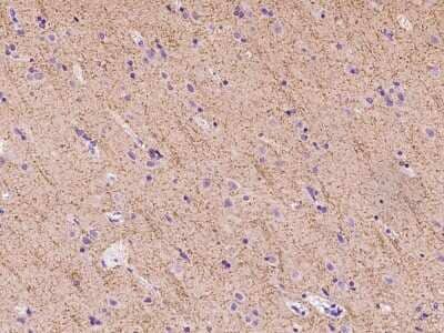 Immunohistochemistry-Paraffin: GAT3 Antibody [NBP2-97671] - Immunochemical staining of human GAT3 in human brain with rabbit polyclonal antibody at 1:100 dilution, formalin-fixed paraffin embedded sections.