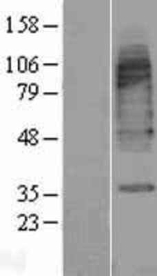 Western Blot GAT3 Overexpression Lysate