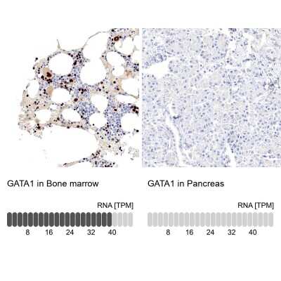 Immunohistochemistry-Paraffin: GATA-1 Antibody [NBP1-84792] - Staining in human bone marrow and pancreas tissues using anti-GATA1 antibody. Corresponding GATA1 RNA-seq data are presented for the same tissues.