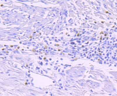 Immunohistochemistry-Paraffin: GATA-1 Antibody (JA10-32) [NBP2-66862] - Analysis of paraffin-embedded human liver tissue using anti-GATA1 antibody. Counter stained with hematoxylin.