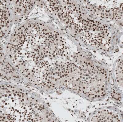 Immunohistochemistry-Paraffin: GATA-3 Antibody [NBP1-83271] - Staining of human testis shows moderate to strong nuclear positivity in cells in seminiferous ducts.