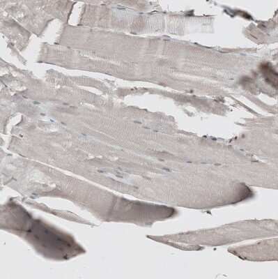 Immunohistochemistry-Paraffin: GATA-3 Antibody [NBP1-83271] - Staining of human skeletal muscle shows no positivity in myocytes as expected.