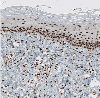 Immunohistochemistry-Paraffin: GATA-3 Antibody [NBP1-83271] - Staining of human cervix, uterine shows moderate to strong nuclear positivity in squamous epithelial cells.