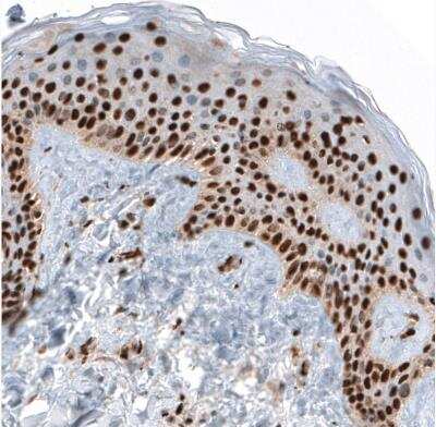 Immunohistochemistry-Paraffin: GATA-3 Antibody [NBP1-83271] - Staining of human skin shows strong nuclear positivity in keratinocytes.