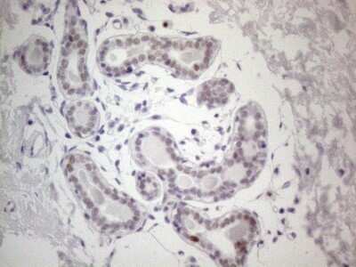 Immunohistochemistry: GATA-3 Antibody (OTI8H4) - Azide and BSA Free [NBP2-70796] - Analysis of Human breast tissue. (Heat-induced epitope retrieval by 1mM EDTA in 10mM Tris buffer (pH8.5) at 120C for 3 min)