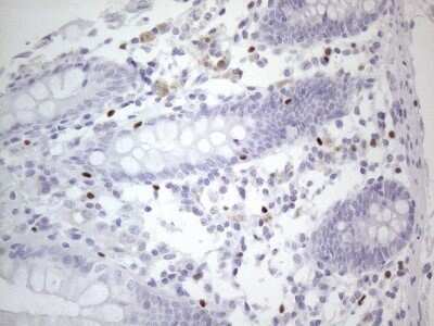 Immunohistochemistry: GATA-3 Antibody (OTI8H4) - Azide and BSA Free [NBP2-70796] - Analysis of Human colon tissue. (Heat-induced epitope retrieval by 1mM EDTA in 10mM Tris buffer (pH8.5) at 120C for 3 min)