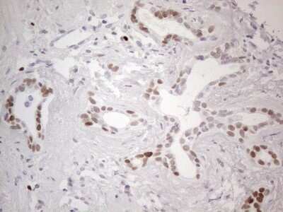 Immunohistochemistry: GATA-3 Antibody (OTI8H4) - Azide and BSA Free [NBP2-70796] - Analysis of Human prostate tissue. (Heat-induced epitope retrieval by 1mM EDTA in 10mM Tris buffer (pH8.5) at 120C for 3 min)