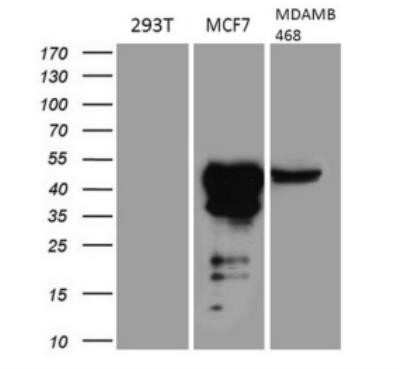 Western Blot: GATA-3 Antibody (OTI8H4) - Azide and BSA Free [NBP2-70796] - Analysis (35ug) from 3 different cell lines by using anti-GATA3 monoclonal antibody.(1:200)