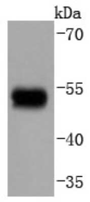 Western Blot: GATA-3 [p Ser308] Antibody (SC52-09) [NBP2-67496] - Analysis of Phospho-GATA3(S308) on human skin lysates using anti-Phospho-GATA3(S308) antibody at 1/1,000 dilution.