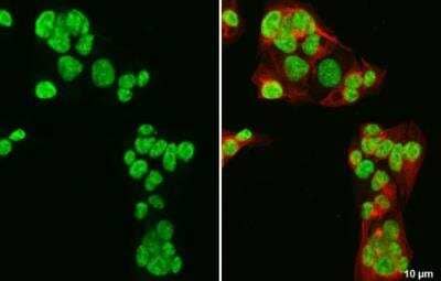 Immunocytochemistry/Immunofluorescence: GATA-4 Antibody [NBP2-16613] - HepG2 cells were fixed in 4% paraformaldehyde at RT for 15 min. Green: GATA4 stained by GATA4 antibody  diluted at 1:500. Red: alpha Tubulin, a cytoskeleton marker, stained by alpha Tubulin antibody [114]  diluted at 1:1000.