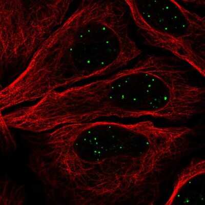 Immunocytochemistry/Immunofluorescence: GATA-4 Antibody [NBP2-56566] - Staining of human cell line U-2 OS shows localization to nuclear bodies.