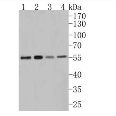 Western Blot: GATA-4 Antibody (JA11-41) [NBP2-66863] - Analysis of GATA4 on different lysates. Proteins were transferred to a PVDF membrane and blocked with 5% BSA in PBS for 1 hour at room temperature. The primary antibody (1/500) was used in 5% BSA at room temperature for 2 hours. Goat Anti-Rabbit IgG - HRP Secondary Antibody at 1:200,000 dilution was used for 1 hour at room temperature. Positive control: Lane 2: Hela cell lysateLane 2: 293 cell lysate Lane 1: Rat liver tissue lysate Lane 2: PC-3 cell lysate