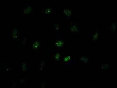 Immunocytochemistry/Immunofluorescence: GATA-4 Antibody (OTI9F9) [NBP1-47765] - Staining of HeLa cells using anti-GATA4 mouse monoclonal antibody.