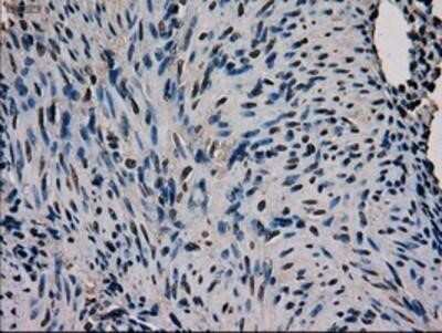 Immunohistochemistry-Paraffin: GATA-4 Antibody (OTI9F9) [NBP1-47765] - Staining of paraffin-embedded Human endometrium tissue using anti-GATA4 mouse monoclonal antibody.