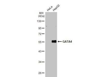 Western Blot: GATA-4 Antibody [NBP2-16613] - Various whole cell extracts (30 ug) were separated by 10% SDS-PAGE, and the membrane was blotted with GATA4 antibody  diluted at 1:1000. The HRP-conjugated anti-rabbit IgG antibody (NBP2-19301) was used to detect the primary antibody.