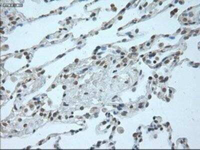 Immunohistochemistry-Paraffin: GATA-6 Antibody (OTI2B3) [NBP1-47766] - Staining of paraffin-embedded Human lung tissue using anti-Gata6 mouse monoclonal antibody.