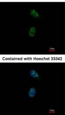 Immunocytochemistry/Immunofluorescence: GATA4 Antibody [NBP2-16613] - Analysis of paraformaldehyde-fixed HeLa, using antibody at 1:500 dilution.