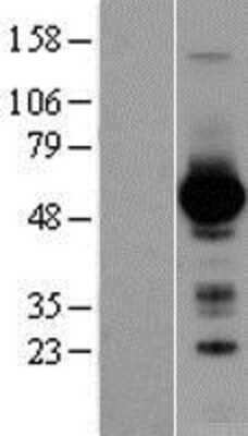 Western Blot: GATA4 Overexpression Lysate (Adult Normal) [NBL1-10983] Left-Empty vector transfected control cell lysate (HEK293 cell lysate); Right -Over-expression Lysate for GATA4.