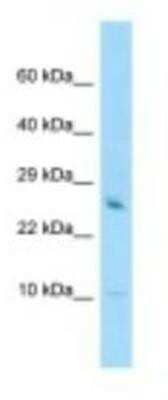 Western Blot: GATC Antibody [NBP1-98402] - THP-1 Cell Lysate 1.0ug/ml, Gel Concentration: 10-20%