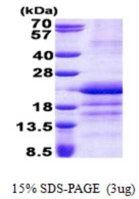 SDS-PAGE Recombinant Human GATC His Protein